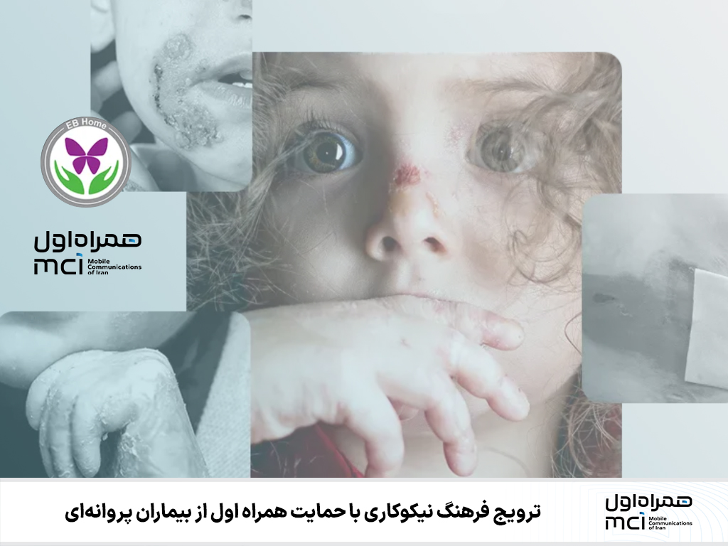 ترویج فرهنگ نیکوکاری با حمایت همراه اول از بیماران پروانهای ترویج فرهنگ نیکوکاری با حمایت همراه اول از بیماران پروانهای